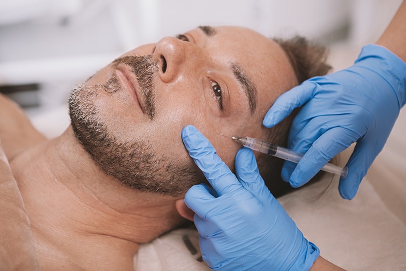 Facial Filler 101: Which Is Right for You? | Newport Medical and Wellness